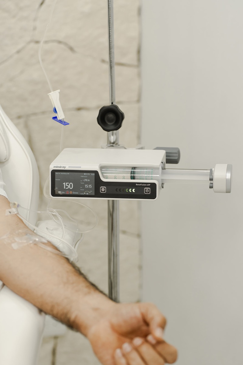 Terapia avanzada de células madre intravenosa administrada con bomba de infusión de precisión en nuestra clínica de Cancún.